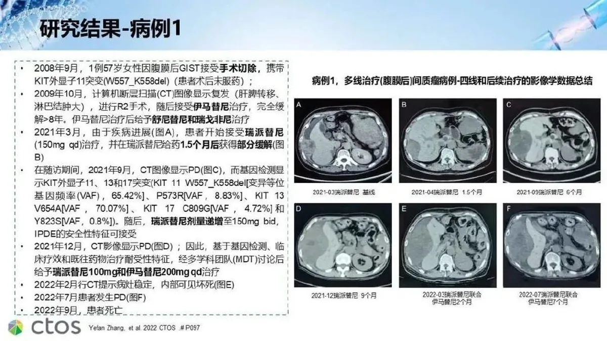 瑞派替尼治疗胃肠道间质瘤的用药场景